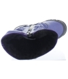 Foot problems special snow boots for girls Foot problems special snow boots for girls
