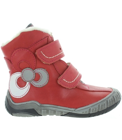 Deformed feet in girls best corrective red snow boots Deformed feet in girls best corrective red snow boots