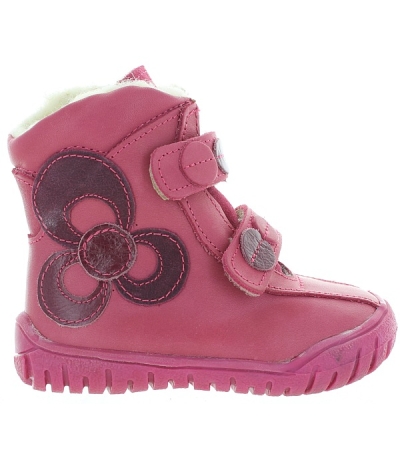 Special pink shoes for foot problems in chidren Special pink shoes for foot problems in chidren